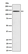 Western blot analysis of Phospho-BCAR1 (Y410) expression in HeLa treated with pervanadate cell lysate, using Phospho-BCAR1 (Tyr410) antibody.