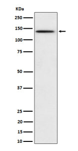 Western blot analysis of Phospho-BCAR1 (Y410) expression in HeLa treated with pervanadate cell lysate, using Phospho-BCAR1 (Tyr410) antibody.