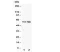 Western blot testing of FMO3 antibody and Lane 1: rat liver; 2: rat liver. Predicted/observed molecular weight ~60kDa.