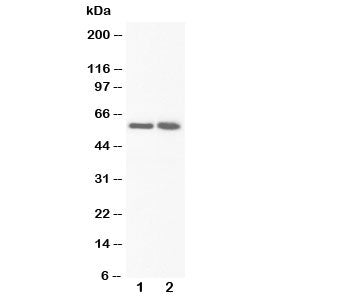Western blot testing of FMO3 antibody and Lane 1: rat liver; 2: rat liver. Predicted/observed molecular weight ~60kDa.