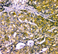 Western blot testing of human 293T cell lysate with NARG1 antibody at 0.5ug/ml. Predicted molecular weight ~101 kDa.