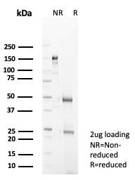 SDS-PAGE analysis of purified, BSA-free IL-18 antibody (clone IL18/4626) as confirmation of integrity and purity.