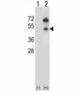 Western blot analysis of GNAS antibody and 293 cell lysate (2 ug/lane) either nontransfected (Lane 1) or transiently transfected (2) with the GNAS gene. Predicted molecular weight ~46kDa.
