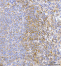 IHC staining of FFPE human spleen tissue with Hamartin antibody. HIER: boil tissue sections in pH8 EDTA for 20 min and allow to cool before testing.