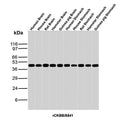 Western blot analysis of Human Brain, Mouse Brain, Rat Brain, Hamster Brain, Guinea pig Brain, Human Stomach, Mouse Stomach, Rat Stomach, Hamster Stomach and Guinea pig Stomach tissue lysates using recombinant Creatine kinase B antibody (clone rCKBB/8841). Predicted molecular weight ~43 kDa.