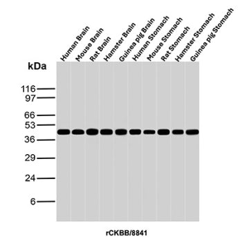Western blot analysis of Human Brain, Mouse Brain, Rat Brain, Hamster Brain, Guinea pig Brain, Human Stomach, Mouse Stomach, Rat Stomach, Hamster Stomach and Guinea pig Stomach tissue lysates using recombinant Creatine kinase B antibody (clone rCKBB/8841). Predicted molecular weight ~43 kDa.