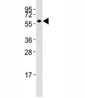 Western blot testing of MMP14 antibody at 1:1000 dilution + HT-1080 lysate; Predicted molecular weight: ~66/54kDa.