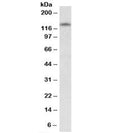Western blot testing of human cerebellum lysate with RIP140 antibody at 0.5ug/ml. Predicted molecular weight: ~127kDa, routinely observed at ~140kDa.