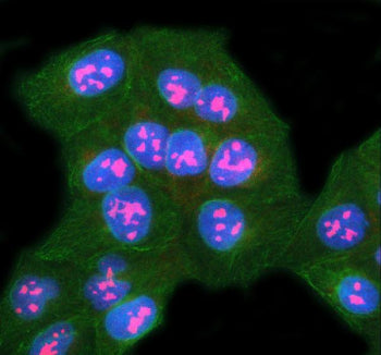 Immunofluorescent staining of SURF6 using anti-SURF6 antibody (red) and anti-Beta Tubulin antibody (green). SURF6 was detected in immunocytochemical section of U2OS cell. Enzyme antigen retrieval was performed using IHC enzyme antigen retrieval reagent for 15 mins. The cells were blocked with 10% goat serum. And then incubated with 5 ug/ml rabbit anti-SURF6 antibody and mouse anti-Beta Tubulin antibody overnight at 4oC.