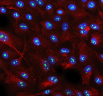 Immunofluorescent staining of AATF using anti-AATF antibody (red). AATF was detected in a paraffin-embedded section of rat brain tissue. Heat mediated antigen retrieval was performed in EDTA buffer (pH 8.0, epitope retrieval solution). The tissue section was blocked with 10% goat serum. The tissue section was then incubated with 5 ug/ml rabbit anti-AATF antibody overnight at 4oC. DyLight 594 Conjugated Goat Anti-Rabbit IgG was used as secondary antibody at 1:500 dilution and incubated for 30 min at 37oC.