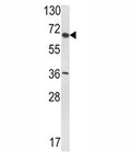 Western blot analysis of VDU1 antibody and T47D lysate.