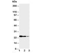 Western blot testing of TNFR1 antibody and Lane 1: Recombinant human TNFR1 protein 10ng; 2: 5ng; 3: 2.5ng