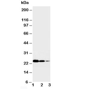 Western blot testing of TNFR1 antibody and Lane 1: Recombinant human TNFR1 protein 10ng; 2: 5ng; 3: 2.5ng