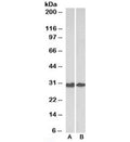 Western blot testing of human [A] and mouse [B] colon lysates with Galectin 3 antibody at 0.3ug/ml. Predicted molecular weight ~26kDa.