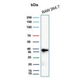 Western blot testing of mouse RAW264.7 cell lysate with recombinant Cyclin D1 antibody. Predicted molecular weight: 32-36 kDa.