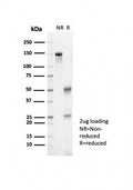 IHC staining of FFPE human skin tissue with Kallikrein 7 antibody (clone KLK7/4692). HIER: boil tissue sections in pH 9 10mM Tris with 1mM EDTA for 20 min and allow to cool before testing.