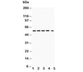 Western blot testing of Akt1 antibody and Lane 1: rat ovary; 2: (r) PC-12; 3: human A549; 4: (h) MCF-7; 5: mouse HEPA lysate; Predicted size: 56 kDa; Observed size: 56 kDa.