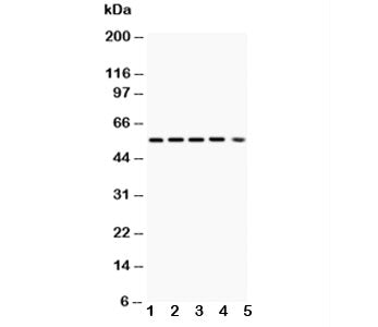 Western blot testing of Akt1 antibody and Lane 1: rat ovary; 2: (r) PC-12; 3: human A549; 4: (h) MCF-7; 5: mouse HEPA lysate; Predicted size: 56 kDa; Observed size: 56 kDa.
