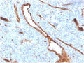 IHC staining of FFPE human bone marrow with recombinant von Willebrand Factor antibody (clone VWF/4384R). HIER: boil tissue sections in pH 9 10mM Tris with 1mM EDTA for 20 min and allow to cool before testing.