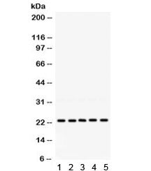 Western blot testing of 1) rat testis, 2) rat lung, 3) human 293, 4) human HeLa and 5) human HepG2 lysate with RAB18 antibody. Expected molecular weight ~23 kDa.