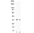 Western blot testing of 1) rat brain and 2) human HeLa lysate with TSG6 antibody at 0.5ug/ml. Predicted molecular weight ~31 kDa.