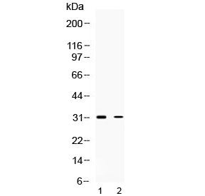 Western blot testing of 1) rat brain and 2) human HeLa lysate with TSG6 antibody at 0.5ug/ml. Predicted molecular weight ~31 kDa.