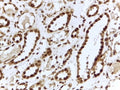 IHC testing of FFPE human kidney with ILF3 antibody at 2ug/ml. HIER: steamed with pH6 citrate buffer, HRP-staining.