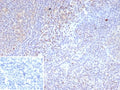IHC staining of FFPE human tonsil tissue with recombinant LEF1 antibody (clone LEF1/9403R). Strong nuclear staining of non-germinal center of cells observed. Inset: PBS used in place of primary Ab (secondary Ab negative control). HIER: boil tissue sections in pH 9 10mM Tris with 1mM EDTA for 20 min and allow to cool before testing.