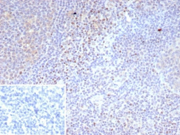 IHC staining of FFPE human tonsil tissue with recombinant LEF1 antibody (clone LEF1/9403R). Strong nuclear staining of non-germinal center of cells observed. Inset: PBS used in place of primary Ab (secondary Ab negative control). HIER: boil tissue sections in pH 9 10mM Tris with 1mM EDTA for 20 min and allow to cool before testing.