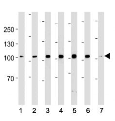 ACE2 antibody western blot analysis in (1) 293, (2) K562, (3) MCF-7, (4) SK-BR-3, (5) T47D, (6) MDA-MB-453 cell line and (7) mouse testis tissue lysate. Predicted molecular weight: 90-100 kDa.