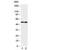 Western blot testing of NFKB2 antibody and Lane 1: mouse liver; 2: (m) HEPA cell lysate. Expected size 52 or 100KD, depending on sample tested