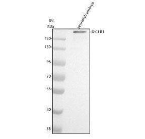 Western blot analysis of Dicer protein using Zebrafish Dicer antibody and zebrafish embryo tissue lysate. The predicted molecular weight of Dicer is ~219 kDa.