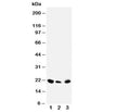 Western blot testing of DUSP3 antibody and Lane 1: rat testis; 2: human SKOV; 3: (h) MM453 cell lysate. Predicted molecular weight ~20 kDa.