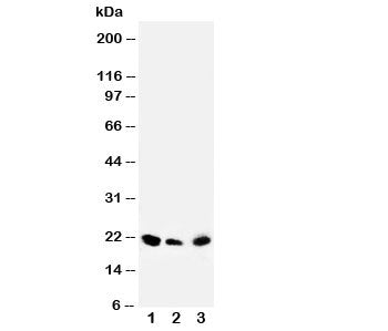 Western blot testing of DUSP3 antibody and Lane 1: rat testis; 2: human SKOV; 3: (h) MM453 cell lysate. Predicted molecular weight ~20 kDa.