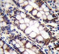 IHC testing of FFPE human rectum tissue with UQCRFS1 antibody. HIER: steam section in pH6 citrate buffer for 20 min and allow to cool prior to staining.