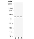 Western blot testing of 1) rat brain, 2) rat testis and 3) human U-87 MG lysate with 5HT2AR antibody. Predicted/observed molecular weight ~53 kDa.