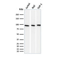 Western blot testing of human 1) Jurkat, 2) Raji and 3) ThP-1 cell lysate with Transferrin receptor antibody (clone DF1513). Predicted molecular weight: 85-95 kDa.
