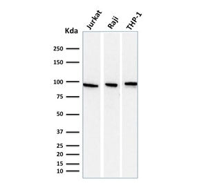 Western blot testing of human 1) Jurkat, 2) Raji and 3) ThP-1 cell lysate with Transferrin receptor antibody (clone DF1513). Predicted molecular weight: 85-95 kDa.