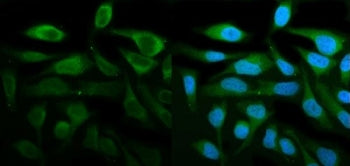Immunofluorescent staining of FFPE human HeLa cells with STAT1 antibody (green) and DAPI nuclear stain (blue). HIER: steam section in pH6 citrate buffer for 20 min.