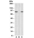 Western blot of HEK293 lysate overexpressing human STAT4-MYC probed with STAT4 antibody [1ug/ml] in Lane A and anti-MYC [1/1000] in lane C. Mock-transfected HEK293 probed with STAT4 antibody [1ug/ml] in Lane B. Predicted molecular weight: ~86kDa.
