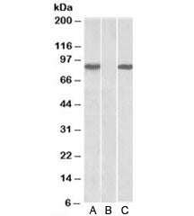 Western blot of HEK293 lysate overexpressing human STAT4-MYC probed with STAT4 antibody [1ug/ml] in Lane A and anti-MYC [1/1000] in lane C. Mock-transfected HEK293 probed with STAT4 antibody [1ug/ml] in Lane B. Predicted molecular weight: ~86kDa.