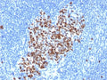 IHC staining of FFPE human lymph node with recombinant TOP2A antibody (clone rTOP2A/6569). HIER: boil tissue sections in pH 9 10mM Tris with 1mM EDTA for 20 min and allow to cool before testing.