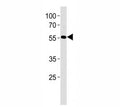 AKT antibody western blot analysis in HL-60 lysate