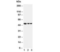 Western blot testing of GFAP antibody and Lane 1: human U87 cell lysate; 2: mouse brain; 3: rat brain. Predicted molecular weight: ~50 kDa.