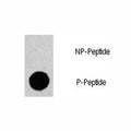 Dot blot analysis of phospho-GAB1 antibody. 50ng of phos-peptide or nonphos-peptide per dot were spotted.
