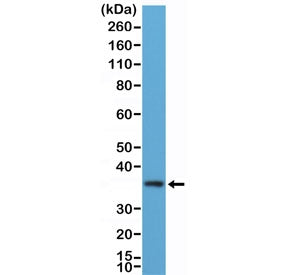 Western blot testing of human K562 cell lysate with recombinant MyD88 antibody at 1:100 dilution. Predicted molecular weight ~33 kDa.