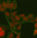 Immunofluorescent staining of FFPE human HeLa cells with PATZ1 antibody (red) and Beta Tubulin mAb (green). HIER: steam section in pH6 citrate buffer for 20 min.