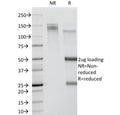 SDS-PAGE Analysis of Purified, BSA-Free CDw78 Antibody (clone DF1588). Confirmation of Integrity and Purity of the Antibody.