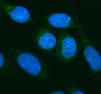 Immunofluorescent staining of MFSD2A using anti-MFSD2A antibody (green). MFSD2A was detected in an immunocytochemical section of SIHA cells. Enzyme antigen retrieval was performed using IHC enzyme antigen retrieval reagent for 15 mins. The cells were blocked with 10% goat serum. And then incubated with 5 ug/ml rabbit anti-MFSD2A antibody overnight at 4oC. DyLight 488 Conjugated Goat Anti-Rabbit IgG was used as secondary antibody at 1:500 dilution and incubated for 30 min at 37oC.