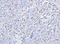 IHC staining of FFPE human uterus tissue with TRPS1 antibody; Strong nuclear staining observed with TRPS1/8131R at 2ug/ml. HIER: boil tissue sections in pH 9 10mM Tris with 1mM EDTA for 20 min and allow to cool before testing.
